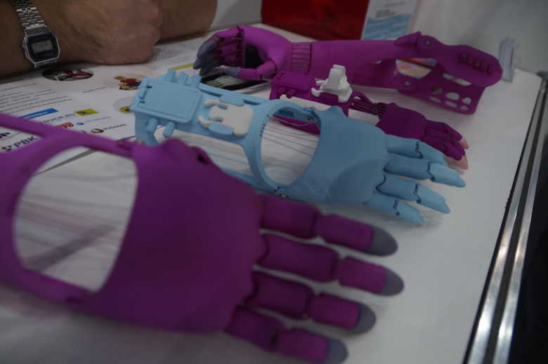 Томичей просят помочь студентке купить современные протезы для рук