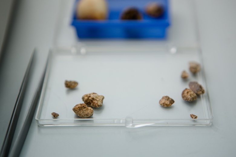 Томские ученые ищут способы безопасного дробления почечных камней