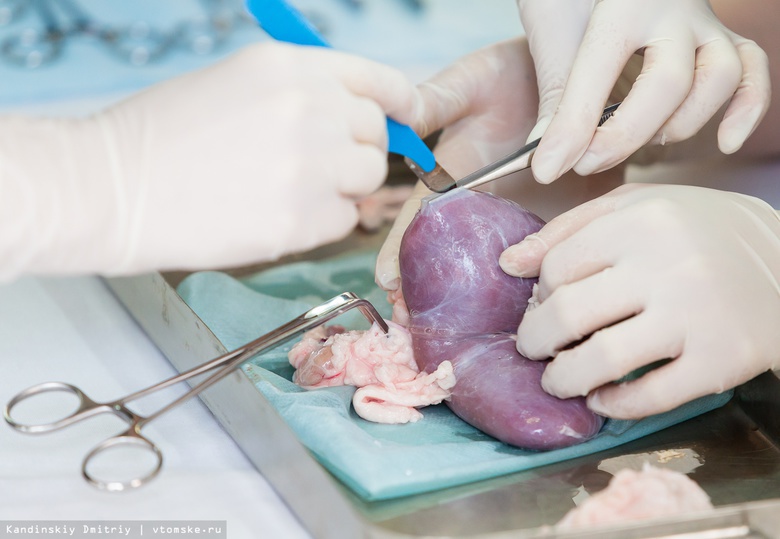 Ножом по опухоли: как урологи учатся оперировать людей