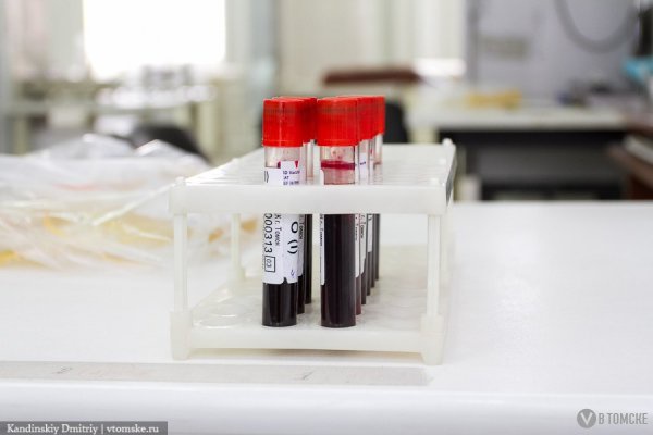 С января томичи смогут пройти тест на ВИЧ в вузах и магазинах
