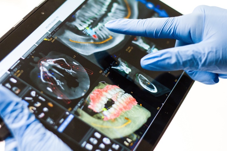 Цифровая имплантация — восстановление с предельной точностью и без боли